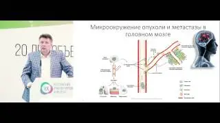 Немелкоклеточный рак легкого с метастазами в головной мозг. Облучение всего головного мозга