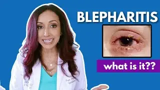 What Is Blepharitis? Eye Doctor Explains