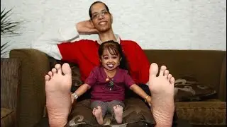 The Smallest People in the World