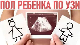 ПОЛ РЕБЕНКА ПО УЗИ | Ошибки в определении пола ребенка | Точность определения пола