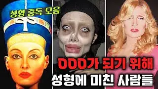 [사건 모음] 타인이 되고싶어 수십번 성형한 사람들