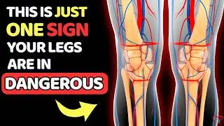 7 Common Signs You Have Poor Leg Blood Circulation Without Even Knowing It.