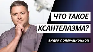 ЧТО ТАКОЕ КСАНТЕЛАЗМА?👀 | БЛЯШКИ НА ВЕКАХ | УДАЛЕНИЕ КСАНТЕЛАЗМЫ КИЕВ | ПЛАСТИКА ВЕК КИЕВ