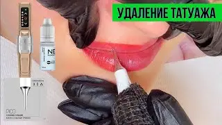 Как удалить татуаж или осветлить перманентный макияж губ? Флакс мини, игла Вертикс, Ремувер Нечаевой