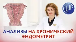 Хронический эндометрит. Какой анализ сдать на хронический эндометрит? Отвечает Дементьева С.Н.