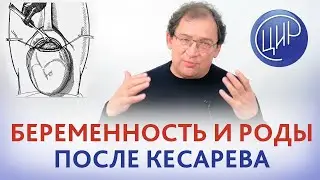 Беременность и роды после кесарева сечения. На что обратить внимание. Рассказывает Гузов И.И.