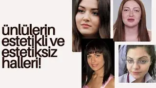 Miracle of Aesthetics: Celebrities Before and After! 🧖‍♀️✨