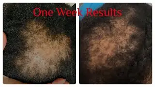 Batana Oil Hair Growth Review Testimonials - Before and After