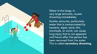 How To Prevent Drowning | Merck Manuals Consumer Version