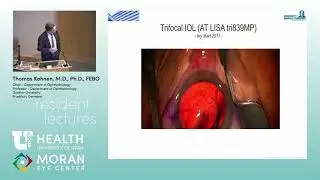 Presbyopia-Correcting IOLs