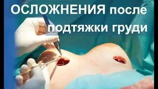 ВАЖНО! 🆘 Подтяжка грудей | ОСЛОЖНЕНИЯ