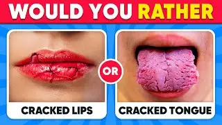 Would You Rather...? HARDEST Choices Ever! 😱😨 Extreme Edition