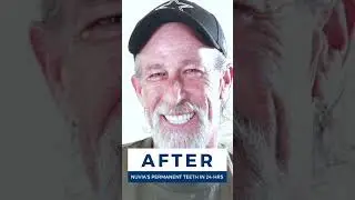 Wait For It! GoodBye Missing Teeth!! 😍😍 #shorts