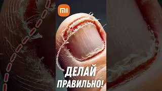 Как СТРИЧЬ НОГТИ БЕЗОПАСНО с XIAOMI #xiaomi #aliexpress #shorts