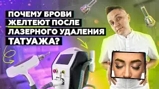 ПОЧЕМУ брови ЖЕЛТЕЮТ после лазерного удаления?