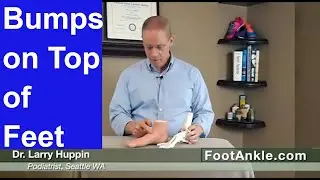 What Causes Bumps on Top of the Feet? Seattle Foot Doctor Larry Huppin