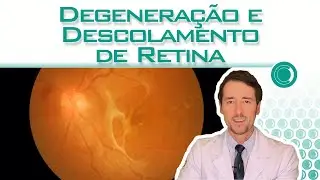 Descolamento e degeneração da retina, qual a diferença?