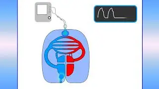 Assessment of fluid responsiveness. Teboul Jean-Louis