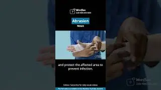 Learn the word abrasion in one minute - Improve your English vocabulary with real world examples