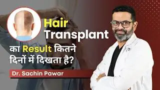 Hair Transplant Results: कब तक करें Expect? | How soon can you expect the results? | HairMD, Pune