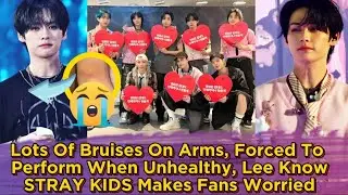 Lots Of Bruises On Arms, Forced To Perform When Unhealthy, Lee Know STRAY KIDS Makes Fans Worried