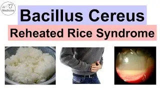 Bacillus Cereus (Reheated Rice Syndrome) Food Poisoning, Pathology, Symptoms, Diagnosis, Treatment