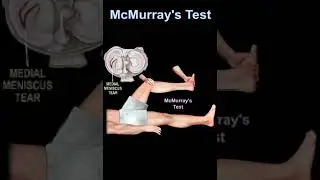 McMurray's Test #shorts