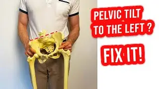 Left pelvic tilt & Herniated disc. One exercise to fix it