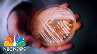 CDC warns dangerous fungus infection poses nationwide threat