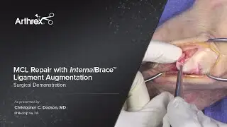 MCL Repair with InternalBrace™ Ligament Augmentation