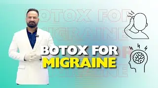 Botox Marking Points for Migraine Relief: Expert Tips by Dr. Ajay Rana