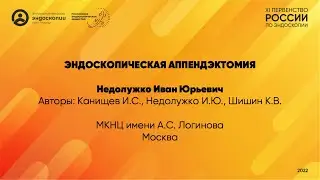 Эндоскопическая аппендэктомия