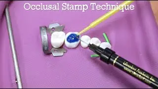 How To Do The Occlusal Stamp Technique