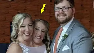 This is how the most famous Siamese twins who got married live now!