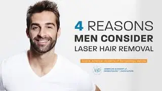 Laser hair removal for men