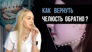 Дистальный прикус. Или как вернуть челюсть обратно?