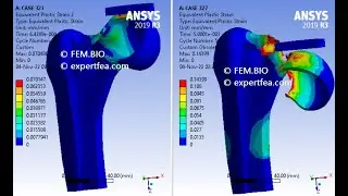 Biomechanics FEA of the Fracture of the Femoral Head With a Rigid Disk - ANSYS WB Explicit Dynamics