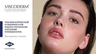 Техники корректной и некорректной работы препаратом Viscoderm  Hydrobooster.