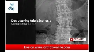The We Are Spine ChatShow: Topic: Decluttering Adult Scoliosis
