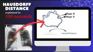 Hausdorff Distance explained  | Image segmentation