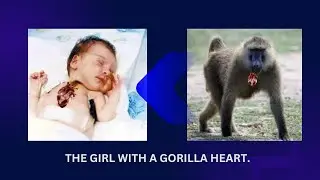 The Girl With A Baboon Heart.