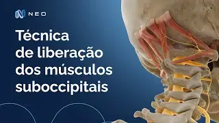 Técnica de liberação suboccipital