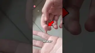 Дополнительный палец! 😱