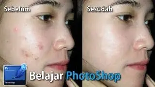 Tutorial Photoshop » Menghilangkan Jerawat Pada Foto Bagian 2