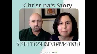 Skin Transformation Testimonial - Christina 💚