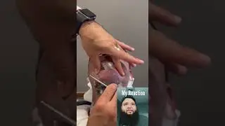 GUY LOSES HIS BEARD 😢😭 #Barber #Shaving #Beard