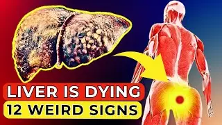 Liver is Dying 12 Weird Signs of Liver Damage Check Yourself