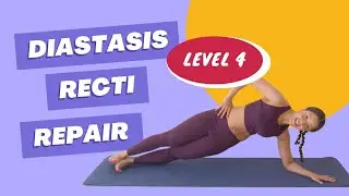 Diastasis Recti Repair Workout | Level 4