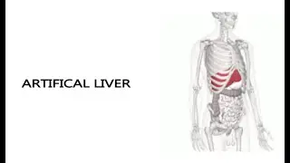 Artificial Liver