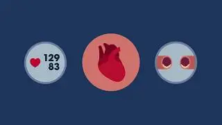 What is a Heart Health Check?